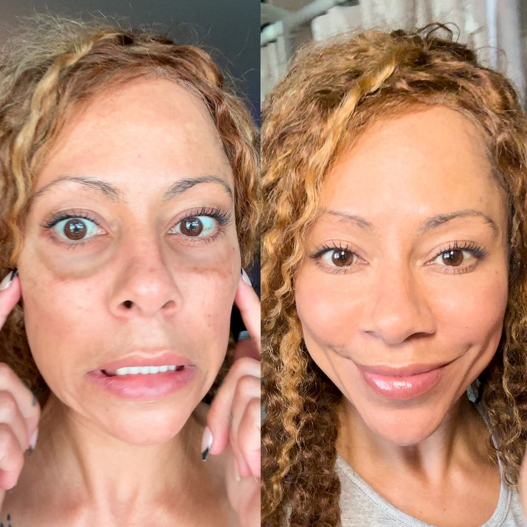 EyePods® 2-in-1 Red Light Therapy + EMS To Erase Eye Bags