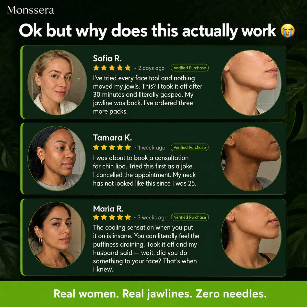CACTOX™ V-Lifting Mewing Band